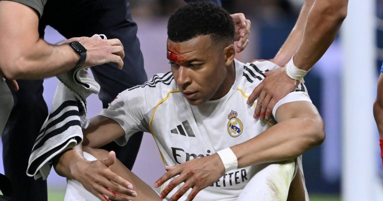 Bayern Kylian Vitor Reis - [EN] Mbappé teve de ser suturado mas está apto para o Bayern
